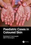 Paediatric Cases in Coloured Skin-9781032343150