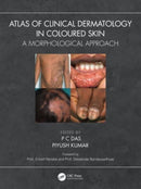 Atlas of Clinical Dermatology in Coloured Skin : A Morphological Approach-9781032399669