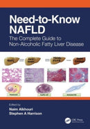 Need-to-Know NAFLD : The Complete Guide to Nonalcoholic Fatty Liver Disease-9781032479484