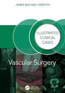 Vascular Surgery: : Illustrated Clinical Cases-9781032804811