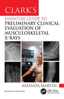 Clark's Essential Guide to Preliminary Clinical Evaluation of Musculoskeletal X-rays-9781032832920