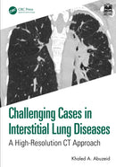 Challenging Cases in Interstitial Lung Diseases : A High-Resolution CT Approach-9781032950051