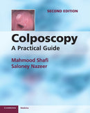 Colposcopy : A Practical Guide-9781107667822