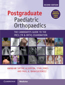 Postgraduate Paediatric Orthopaedics : The Candidate's Guide to the FRCS(Tr&Orth) Examination-9781108970617