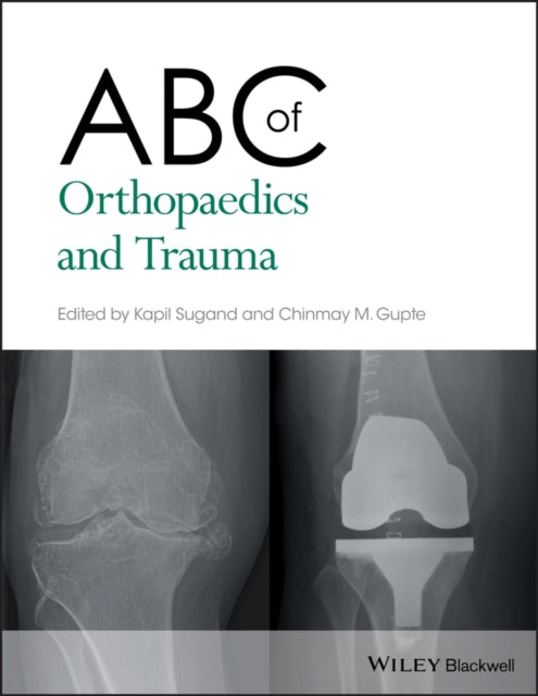 ABC of Orthopaedics and Trauma-9781118561225