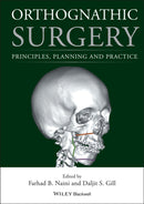 Orthognathic Surgery : Principles, Planning and Practice-9781118649978