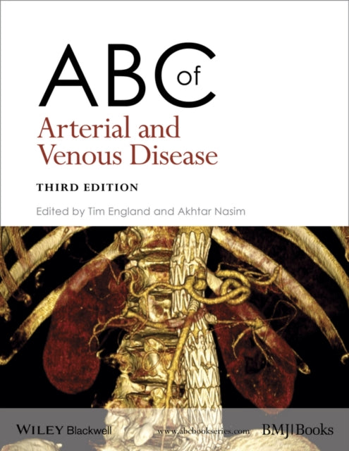 ABC of Arterial and Venous Disease-9781118740682