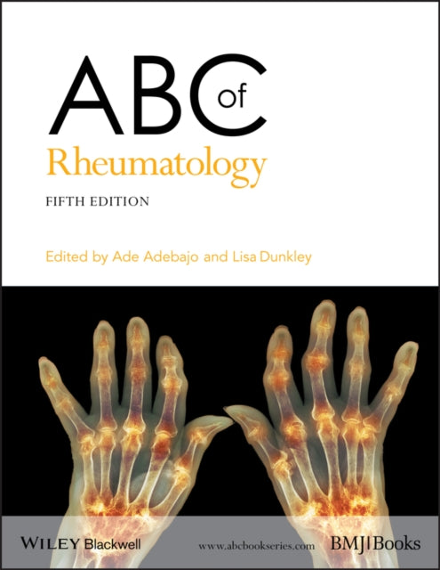 ABC of Rheumatology-9781118793213