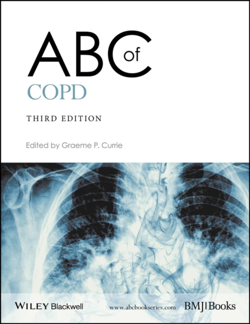 ABC of COPD-9781119212850