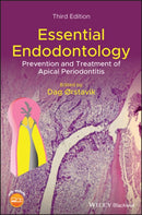 Essential Endodontology : Prevention and Treatment of Apical Periodontitis-9781119271956