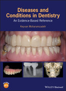 Diseases and Conditions in Dentistry – An Evidence–Based Reference