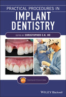 Practical Procedures in Implant Dentistry-9781119399179