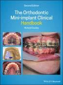 The Orthodontic Mini–implant Clinical Handbook 2nd  Edition
