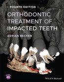 Orthodontic Treatment of Impacted Teeth-9781119565376