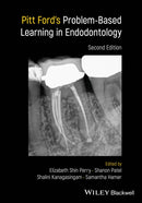 Pitt Ford's Problem–Based Learning in Endodontology 2nd Edition