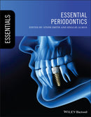 Essential Periodontics-9781119619628