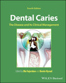 Dental Caries : The Disease and its Clinical Management-9781119679370