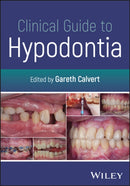 Clinical Guide to Hypodontia-9781119795896