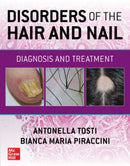 Disorders of the Hair and Nail: Diagnosis and Treatment-9781260462470