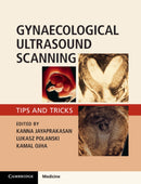 Gynaecological Ultrasound Scanning : Tips and Tricks-9781316645178