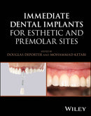 Immediate Dental Implants for Esthetic and Premolar Sites-9781394187102