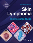 Skin Lymphoma : The Illustrated Guide-9781394235483
