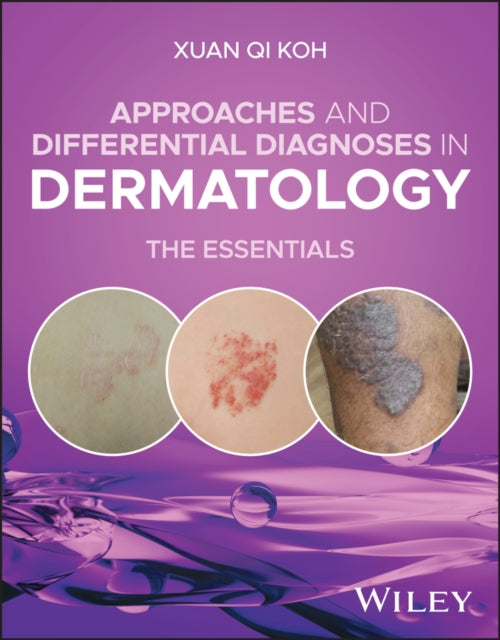 Approaches and Differential Diagnoses in Dermatology