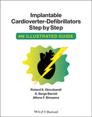 Implantable Cardioverter - Defibrillators Step by Step : An Illustrated Guide-9781405186384