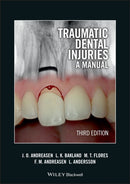 Traumatic Dental Injuries : A Manual-9781405190619