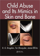 Child Abuse and its Mimics in Skin and Bone-9781439855355