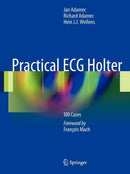 Practical ECG Holter : 100 Cases-9781441999542