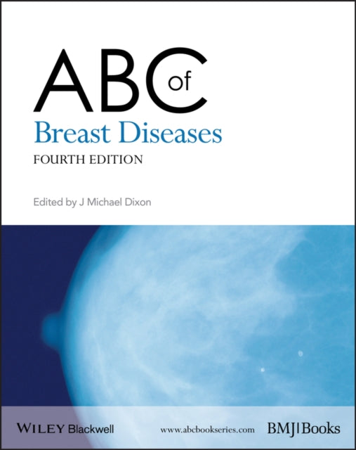 ABC of Breast Diseases-9781444337969