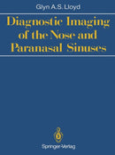 Diagnostic Imaging of the Nose and Paranasal Sinuses-9781447116318