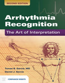 Arrhythmia Recognition: the Art of Interpretation : The Art of Interpretation-9781449642334