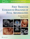 First Trimester Ultrasound Diagnosis of Fetal Abnormalities-9781451193725