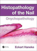 Histopathology of the Nail : Onychopathology-9781482212327