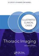 Thoracic Imaging