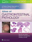 Atlas of Gastrointestinal Pathology: A Pattern Based Approach to Neoplastic Biopsies-9781496367549