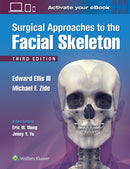 Surgical Approaches to the Facial Skeleton-9781496380418
