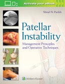 Patellar Instability : Management Principles and Operative Techniques-9781496380821