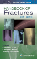 Handbook of Fractures-9781496384850