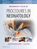 MacDonald's Atlas of Procedures in Neonatology-9781496394255