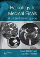 Radiology for Medical Finals : A case-based guide-9781498782166