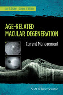 Age-Related Macular Degeneration : Current Management-9781617116421