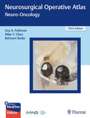 Neurosurgical Operative Atlas: Neuro-Oncology-9781626231085