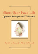 Short-Scar Face Lift : Operative Strategies and Techniques-9781626236325