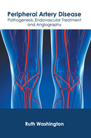 Peripheral Artery Disease: Pathogenesis, Endovascular Treatment and Angiography-9781632429186