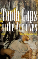 Tooth Gaps in the Archives
