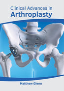 Clinical Advances in Arthroplasty-9781639273911