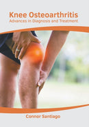Knee Osteoarthritis: Advances in Diagnosis and Treatment-9781639273973